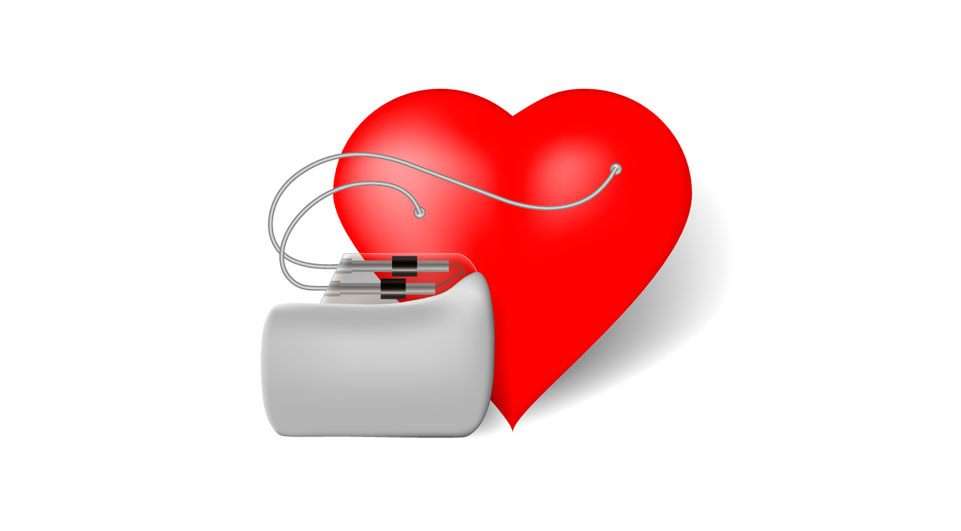 Procedimento: Estimulação Cardíaca - Marca-passos, Desfibriladores e Ressincronizadores