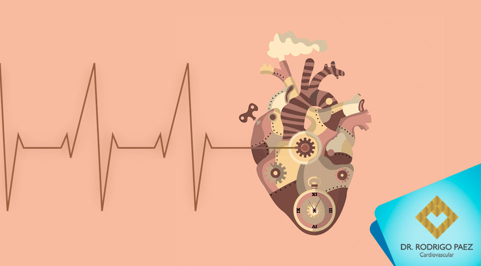 O que é Bloqueio de Ramo Cardíaco?