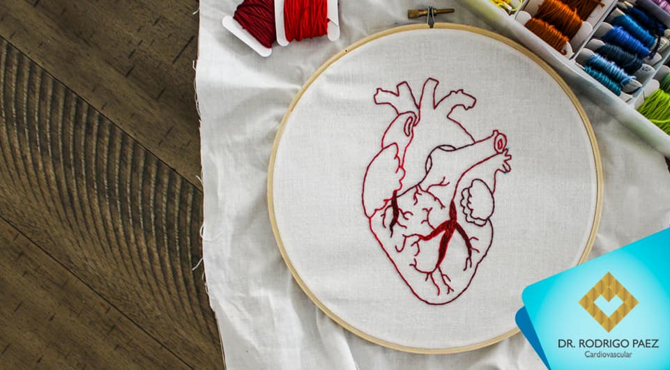 O que você precisa saber sobre cirurgia cardíaca?