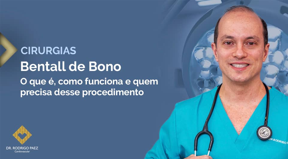 Cirurgia de Bentall de Bono: O que é, como funciona e quem precisa desse procedimento.