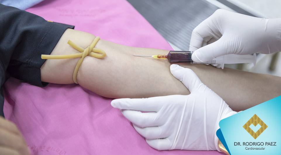 Estudo inédito mostra que exame de sangue pode identificar doenças coronárias.