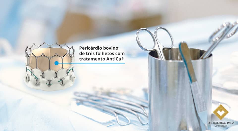 Qual a duração de uma prótese TAVI - Implante Transcateter de Válvula Aórtica?