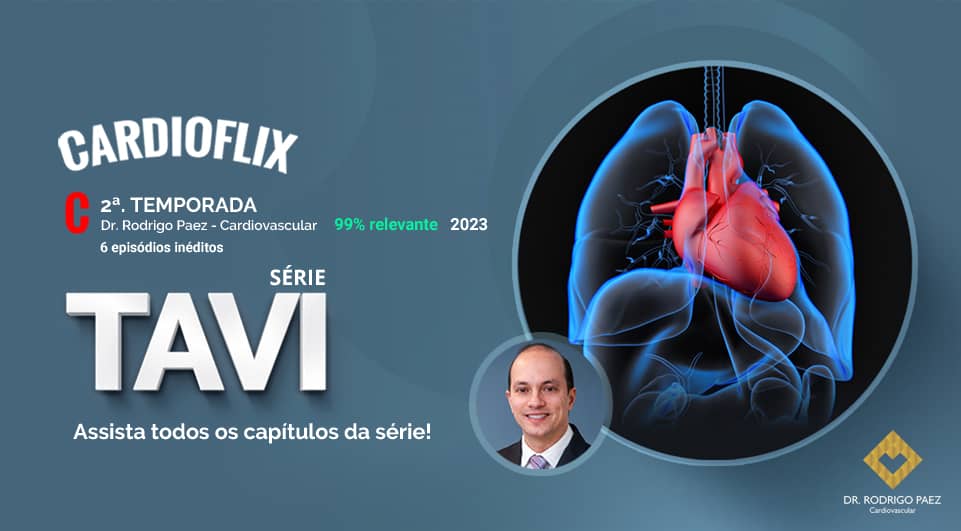 Série sobre TAVI - Implante Transcateter da Válvula Aórtica - 2ª. temporada.
